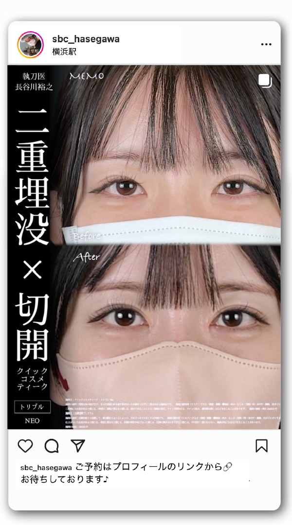 二重埋没