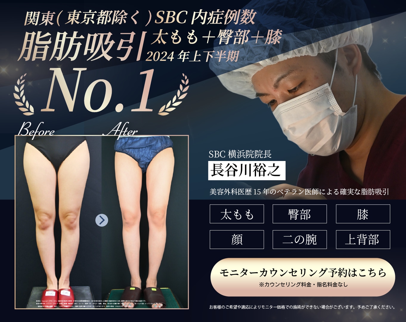 脂肪吸引モニター