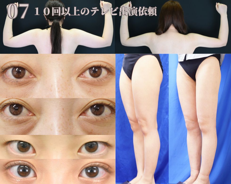 選ばれる理由