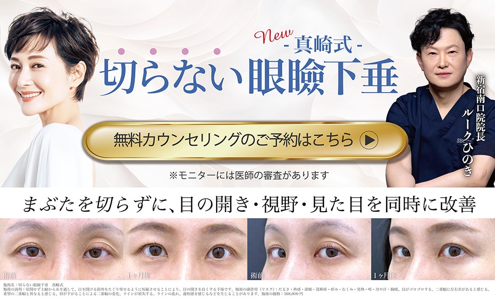 切らない眼形下垂