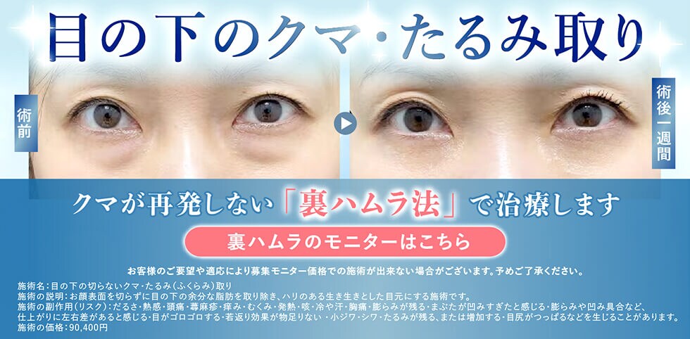 クマ取りモニター