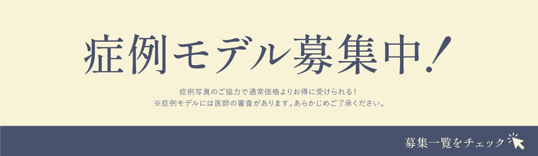 モニター一覧