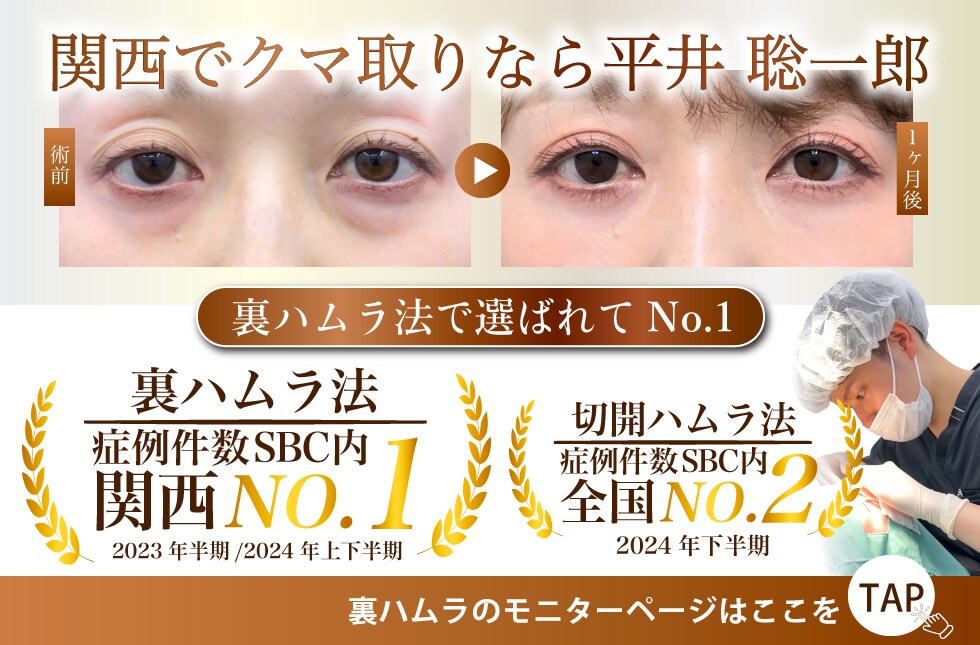 裏ハムラ