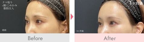 症例写真