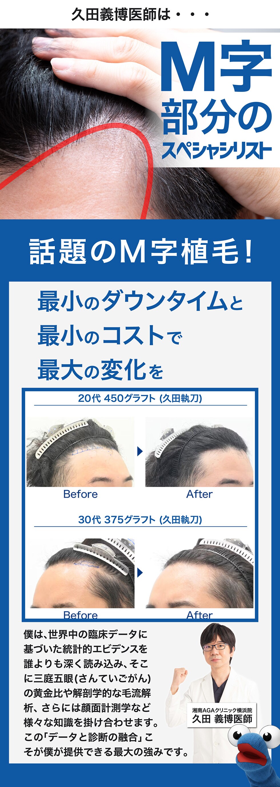 M字部分のスペシャリスト