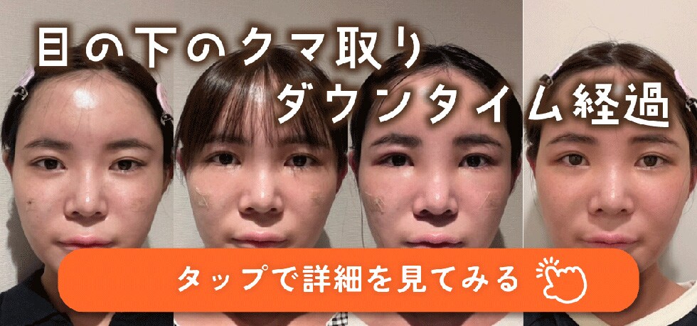 クマとりダウンタイム経過