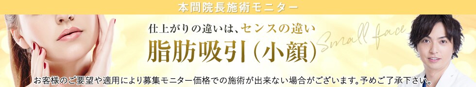 本間院長脂肪吸引(小顔術)モニター