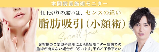 本間院長脂肪吸引(小顔術)モニター