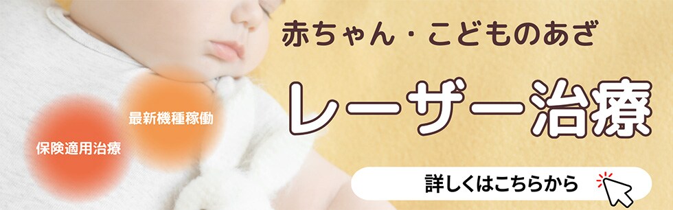 こどものあざレーザー治療