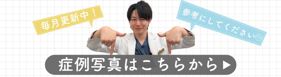 症例写真