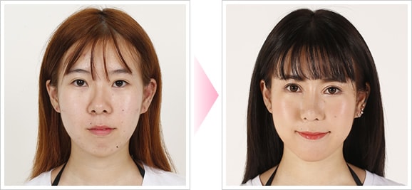 居川和広医師 美容整形 美容外科 美容皮膚科なら湘南美容クリニック 公式