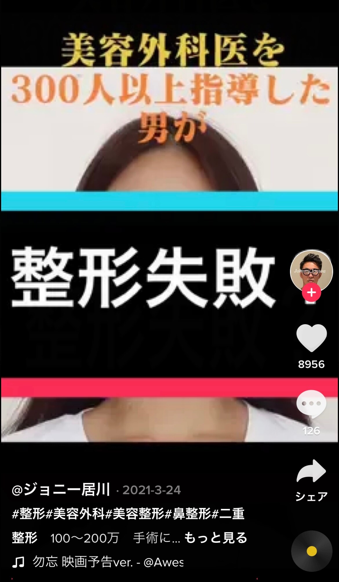 整形失敗