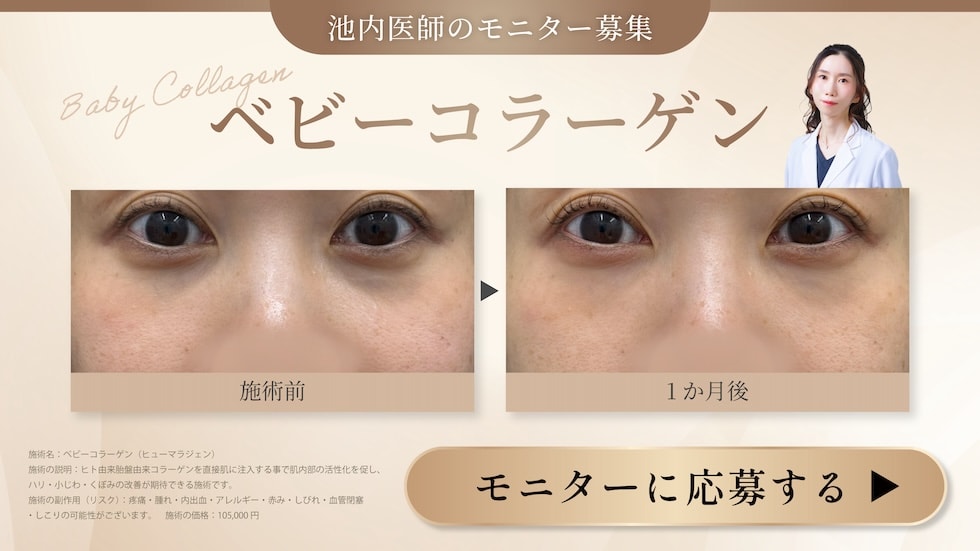 美肌特集を見る