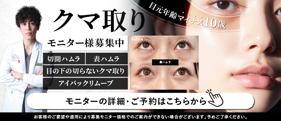 クマとりモニター