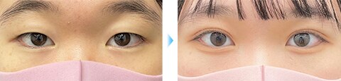 症例写真1