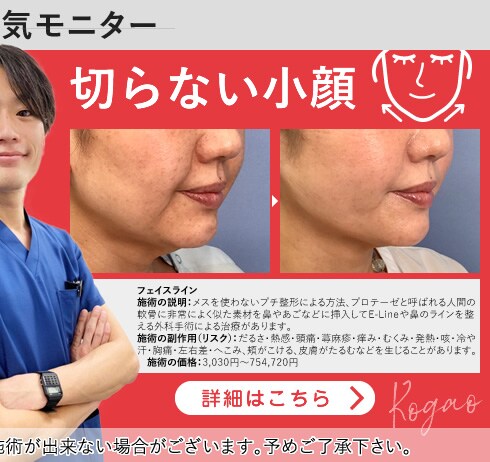 切らない小顔モニター募集