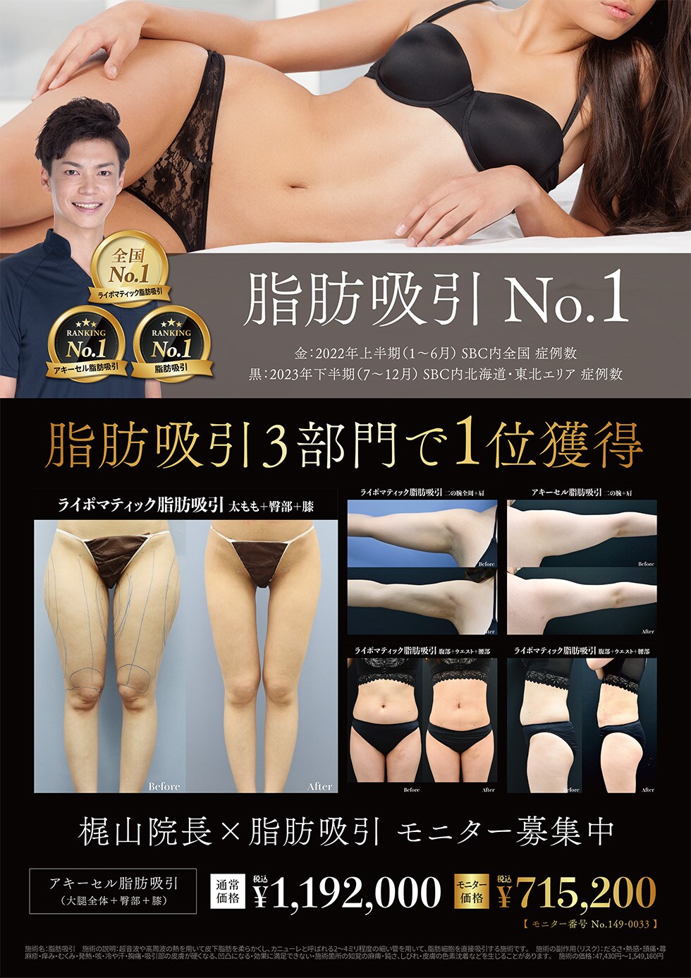 脂肪吸引モニター