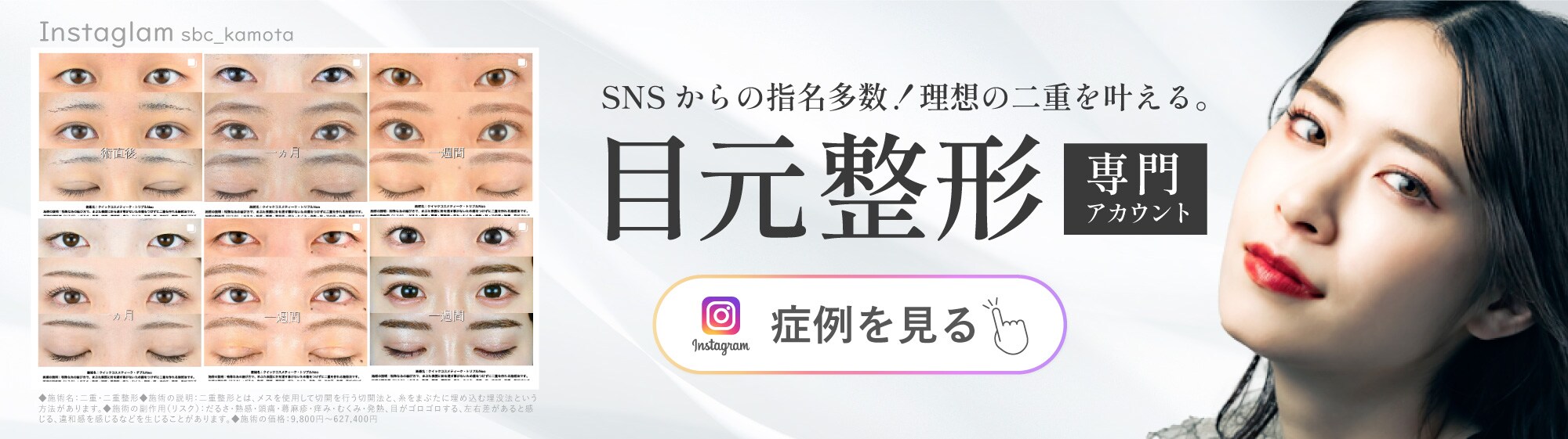 目元整形