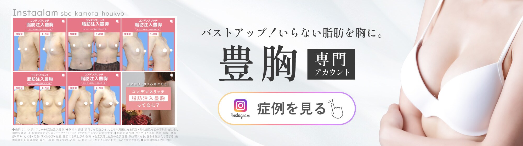 豊胸