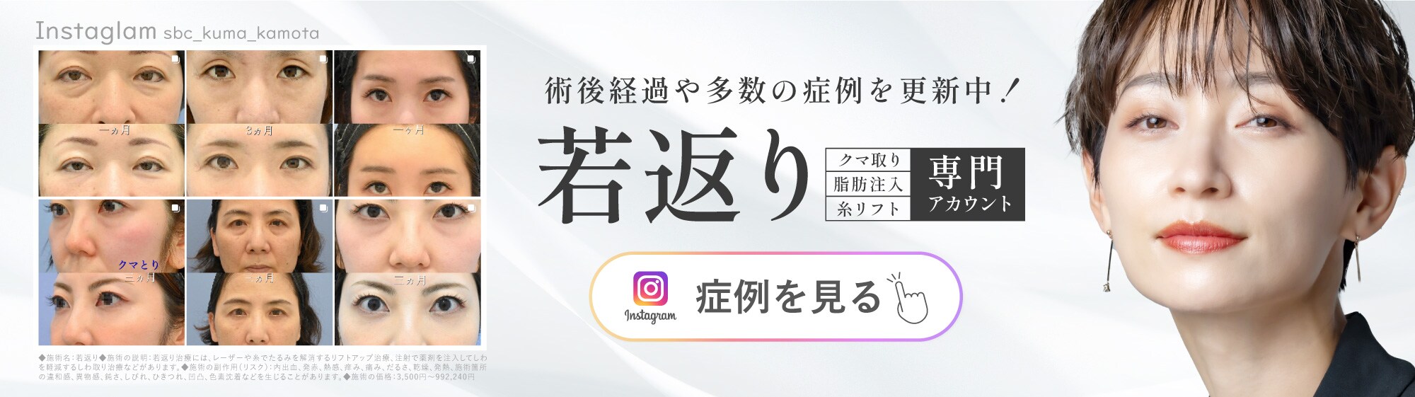 若返り