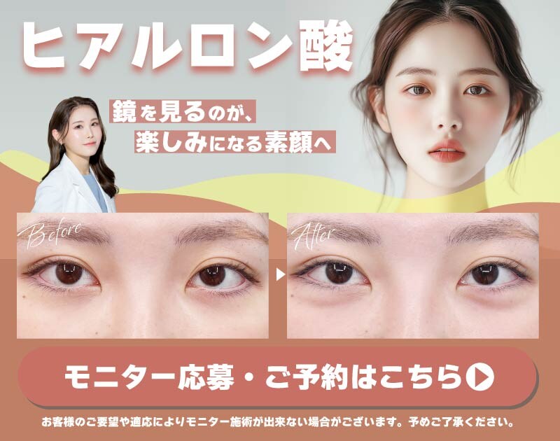 ヒアルロン酸モニター募集