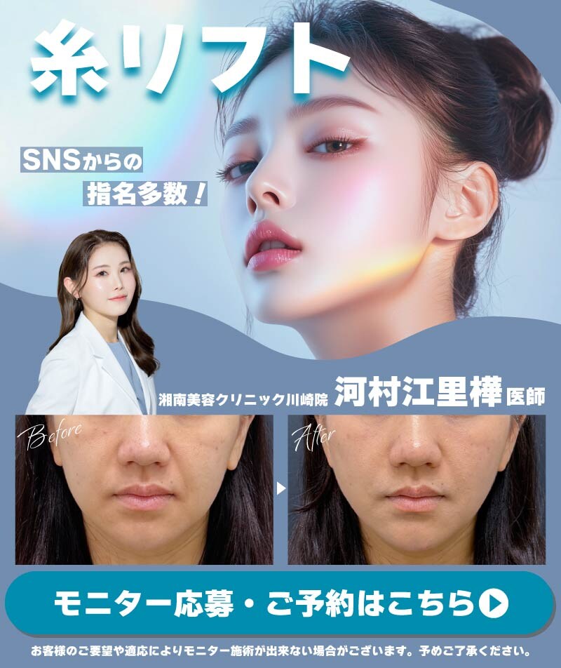 糸リフトモニター募集