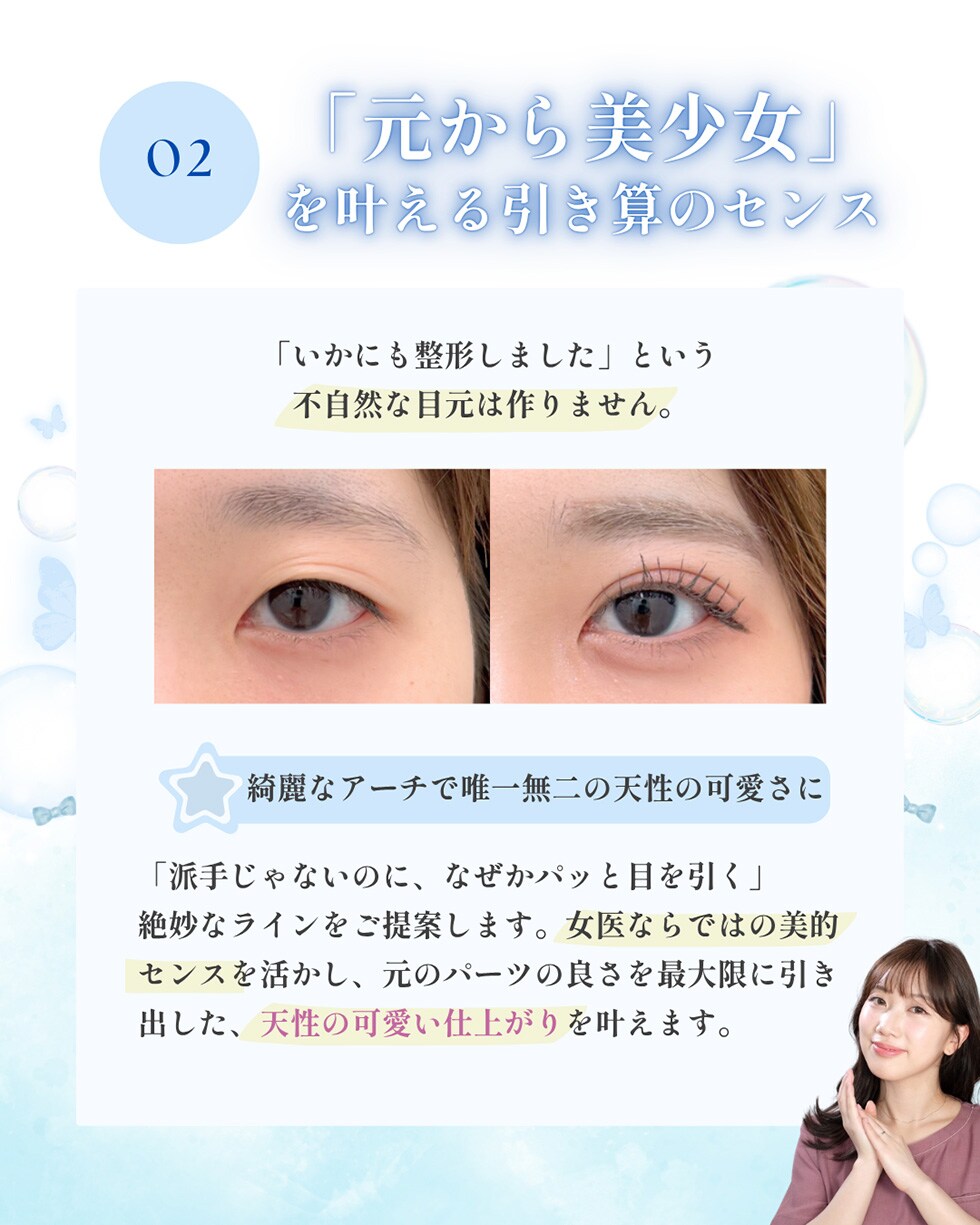 埋没二重モニター募集