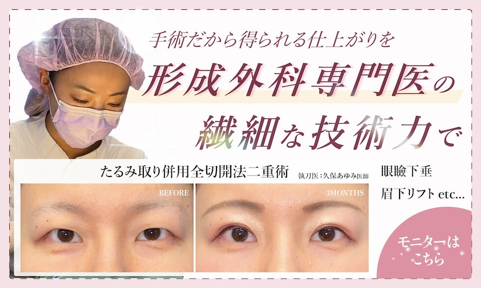 モニターはこちら