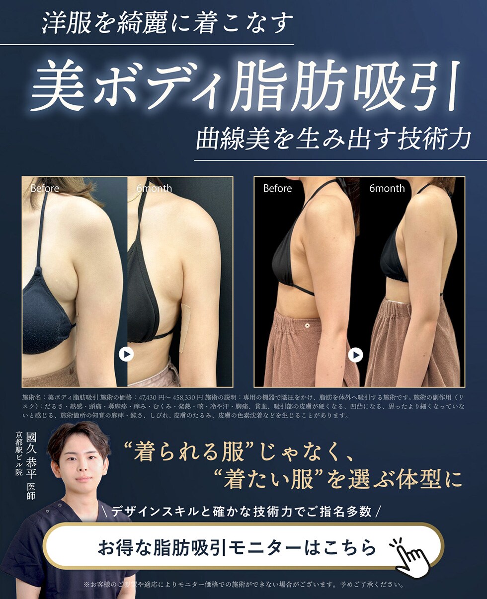 脂肪吸引モニター募集