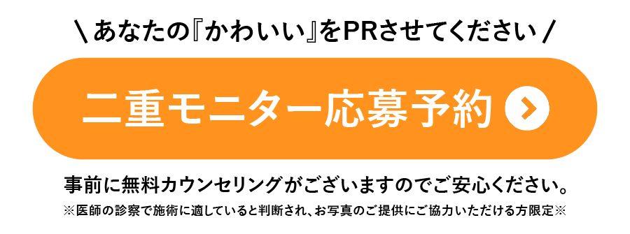ナチュラルアップデート