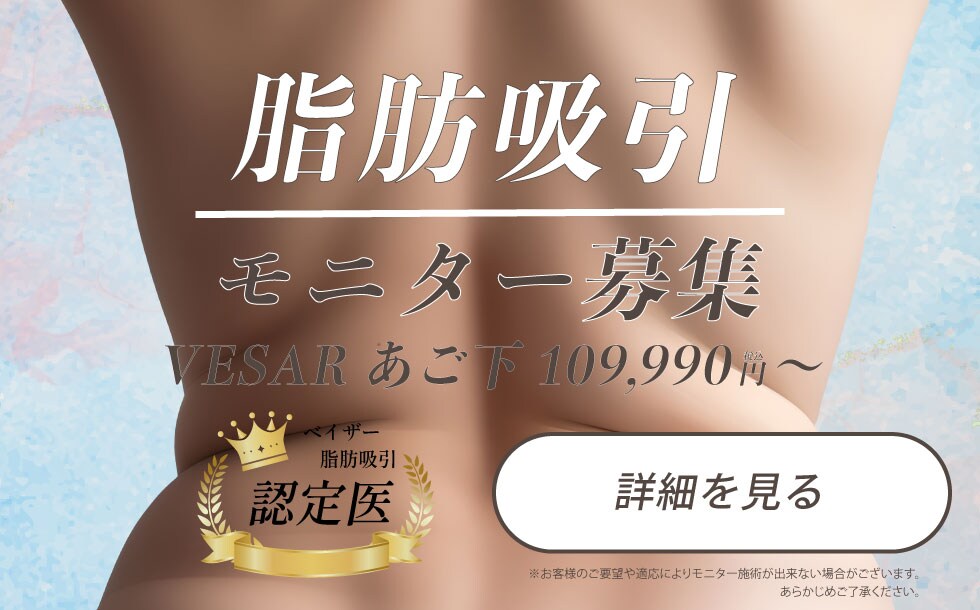 脂肪吸引