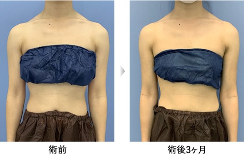 ベテランdr が叶える二の腕美人特集 美容整形 美容外科 美容皮膚科なら湘南美容クリニック 公式