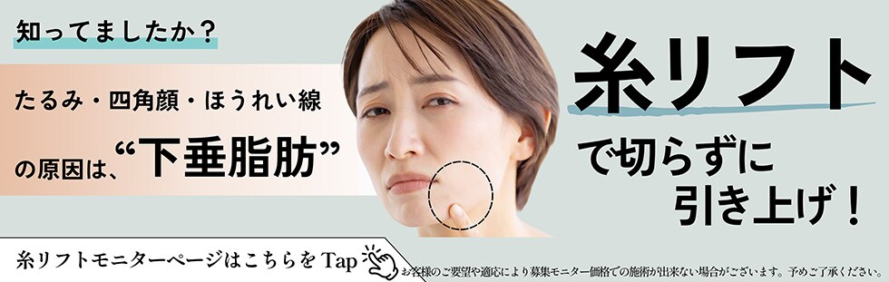 糸リフトモニター募集