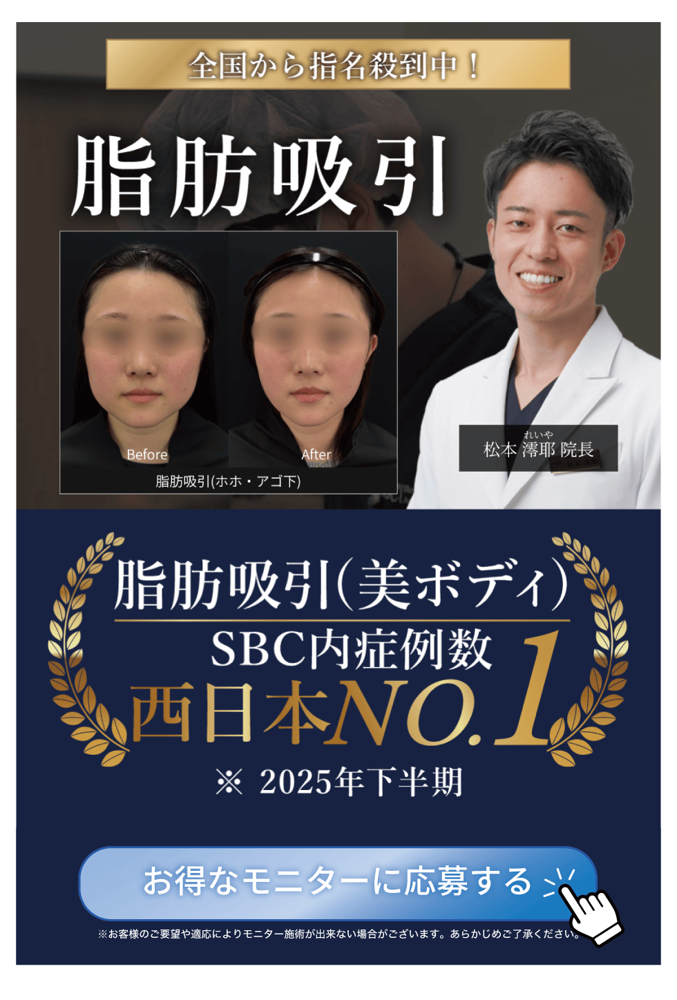 脂肪吸引 SBC内症例数西日本No.1