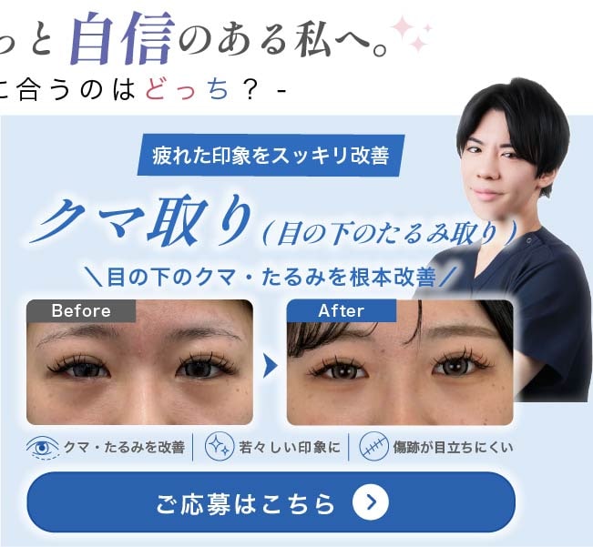 クマ取り