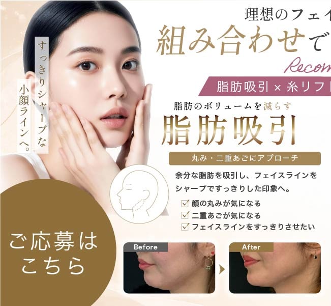 脂肪吸引