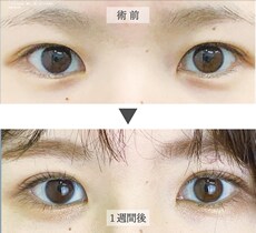 症例写真