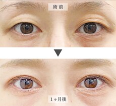 症例写真