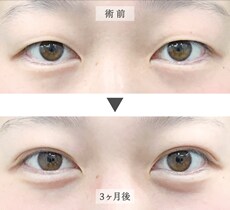 症例写真