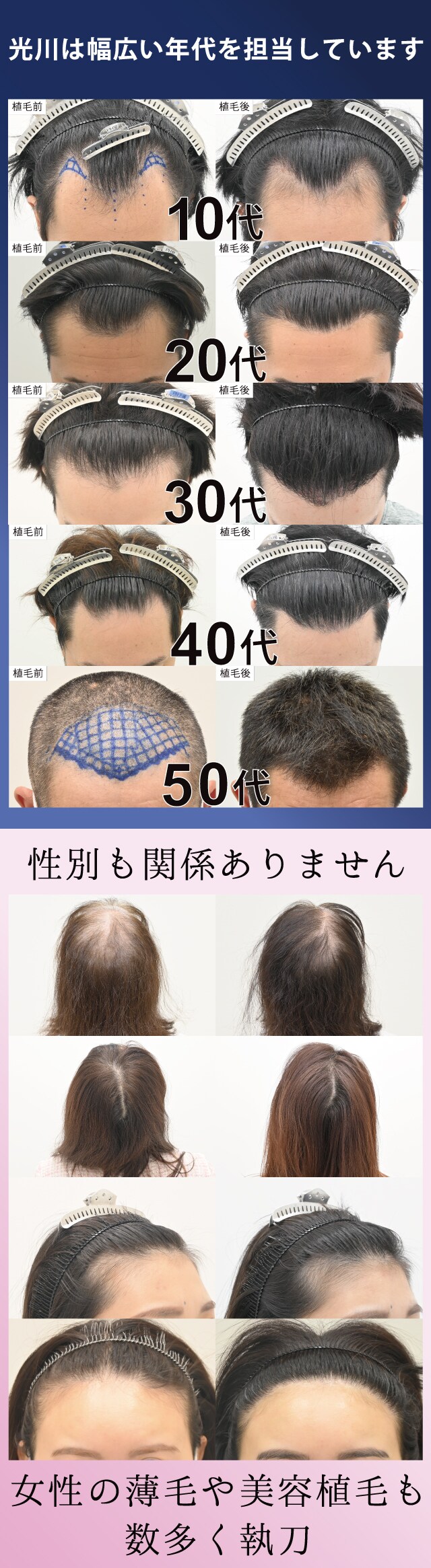 執刀件数全国NO.1ドクター