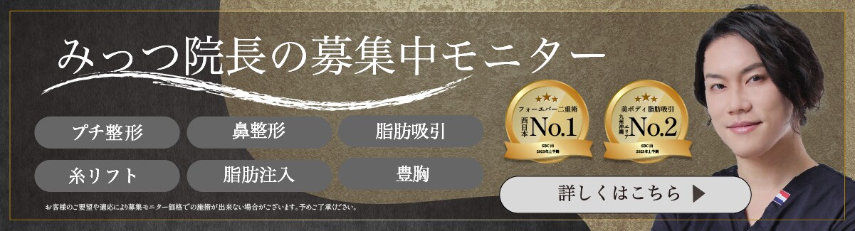 募集中モニター