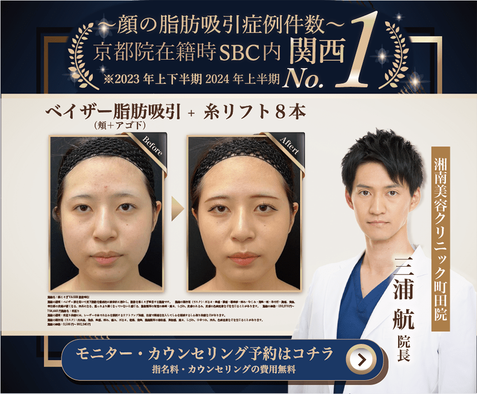 モニターカウンセリング予約はこちら
