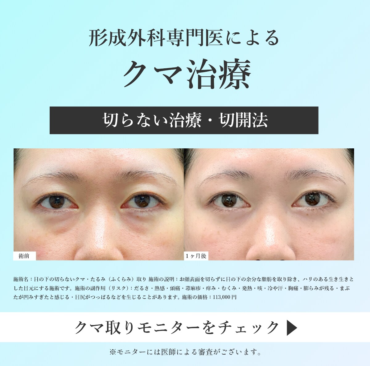 クマ治療