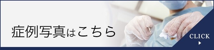 症例写真
