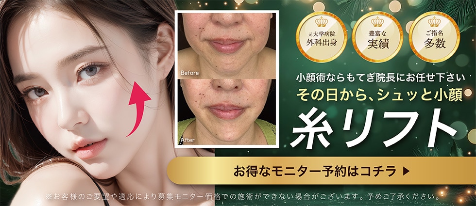 糸リフトモニター