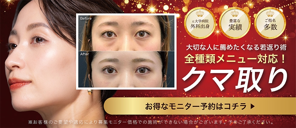 クマ取りモニター