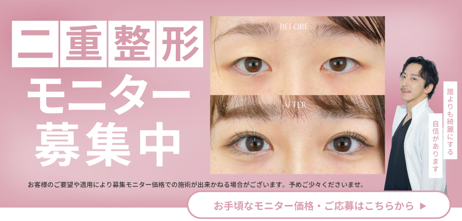 二重整形モニター募集中