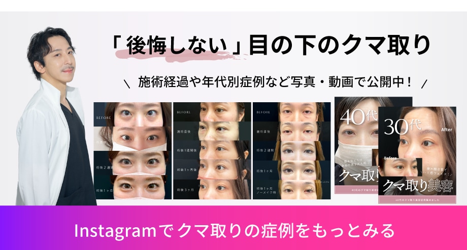 クマ取り
