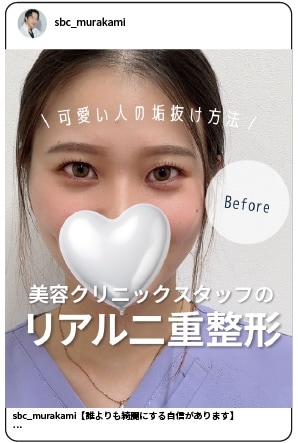 insta二重