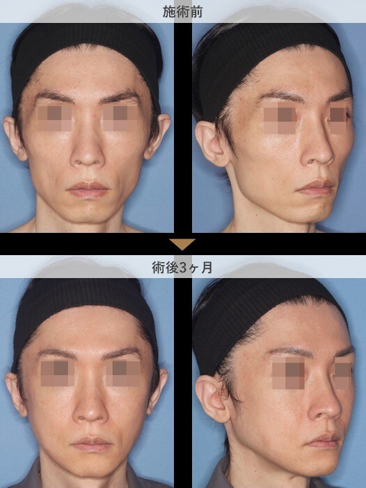 症例写真
